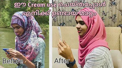 vibha skin care cream review Malayalam|വിഭ ക്രീം| My experience| side effects| Our life&pharma